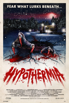 Hypothermia